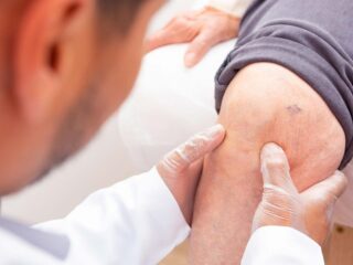 Diz Kireçlenmesi Ortopedi