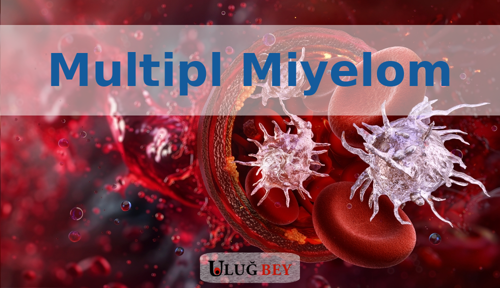 Multipl Miyelom: Nedir ve Belirtileri Nelerdir?